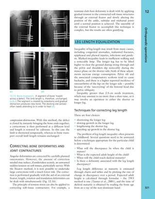 Apley's shoulderjt examination