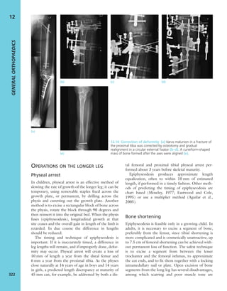 Apley's shoulderjt examination