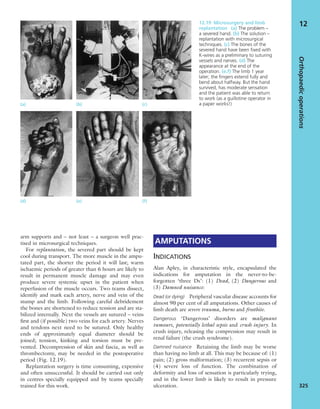 Apley's shoulderjt examination