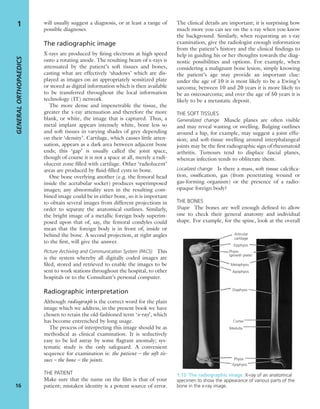 will usually suggest a diagnosis, or at least a range of
possible diagnoses.
The radiographic image
X-rays are produced by ﬁring electrons at high speed
onto a rotating anode. The resulting beam of x-rays is
attenuated by the patient’s soft tissues and bones,
casting what are effectively ‘shadows’ which are dis-
played as images on an appropriately sensitized plate
or stored as digital information which is then available
to be transferred throughout the local information
technology (IT) network.
The more dense and impenetrable the tissue, the
greater the x-ray attenuation and therefore the more
blank, or white, the image that is captured. Thus, a
metal implant appears intensely white, bone less so
and soft tissues in varying shades of grey depending
on their ‘density’. Cartilage, which causes little atten-
uation, appears as a dark area between adjacent bone
ends; this ‘gap’ is usually called the joint space,
though of course it is not a space at all, merely a radi-
olucent zone ﬁlled with cartilage. Other ‘radiolucent’
areas are produced by ﬂuid-ﬁlled cysts in bone.
One bone overlying another (e.g. the femoral head
inside the acetabular socket) produces superimposed
images; any abnormality seen in the resulting com-
bined image could be in either bone, so it is important
to obtain several images from different projections in
order to separate the anatomical outlines. Similarly,
the bright image of a metallic foreign body superim-
posed upon that of, say, the femoral condyles could
mean that the foreign body is in front of, inside or
behind the bone. A second projection, at right angles
to the ﬁrst, will give the answer.
Picture Archiving and Communication System (PACS) This
is the system whereby all digitally coded images are
ﬁled, stored and retrieved to enable the images to be
sent to work stations throughout the hospital, to other
hospitals or to the Consultant’s personal computer.
Radiographic interpretation
Although radiograph is the correct word for the plain
image which we address, in the present book we have
chosen to retain the old-fashioned term ‘x-ray’, which
has become entrenched by long usage.
The process of interpreting this image should be as
methodical as clinical examination. It is seductively
easy to be led astray by some ﬂagrant anomaly; sys-
tematic study is the only safeguard. A convenient
sequence for examination is: the patient – the soft tis-
sues – the bone – the joints.
THE PATIENT
Make sure that the name on the ﬁlm is that of your
patient; mistaken identity is a potent source of error.
The clinical details are important; it is surprising how
much more you can see on the x-ray when you know
the background. Similarly, when requesting an x-ray
examination, give the radiologist enough information
from the patient’s history and the clinical ﬁndings to
help in guiding his or her thoughts towards the diag-
nostic possibilities and options. For example, when
considering a malignant bone lesion, simply knowing
the patient’s age may provide an important clue:
under the age of 10 it is most likely to be a Ewing’s
sarcoma; between 10 and 20 years it is more likely to
be an osteosarcoma; and over the age of 50 years it is
likely to be a metastatic deposit.
THE SOFT TISSUES
Generalized change Muscle planes are often visible
and may reveal wasting or swelling. Bulging outlines
around a hip, for example, may suggest a joint effu-
sion; and soft-tissue swelling around interphalangeal
joints may be the ﬁrst radiographic sign of rheumatoid
arthritis. Tumours tend to displace fascial planes,
whereas infection tends to obliterate them.
Localized change Is there a mass, soft tissue calciﬁca-
tion, ossiﬁcation, gas (from penetrating wound or
gas-forming organism) or the presence of a radio-
opaque foreign body?
THE BONES
Shape The bones are well enough deﬁned to allow
one to check their general anatomy and individual
shape. For example, for the spine, look at the overall
GENERALORTHOPAEDICS
16
1
1.13 The radiographic image X-ray of an anatomical
specimen to show the appearance of various parts of the
bone in the x-ray image.
Articular
cartilage
Epiphysis
Physis
(growth plate)
Metaphysis
Apophysis
Diaphysis
Cortex
Medulla
Physis
Epiphysis
 