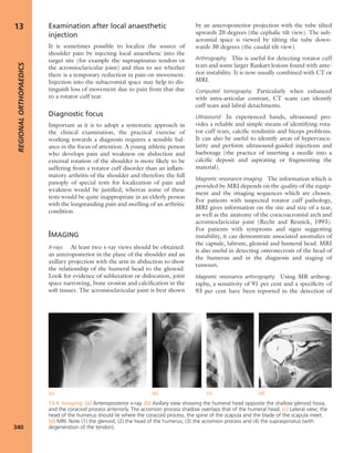 Apley's shoulderjt examination