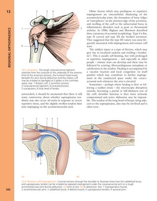 Apley's shoulderjt examination