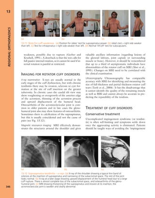 Apley's shoulderjt examination
