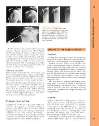 Apley's shoulderjt examination