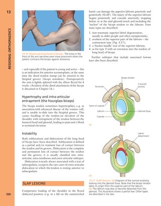 Apley's shoulderjt examination