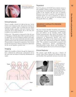 Apley's shoulderjt examination