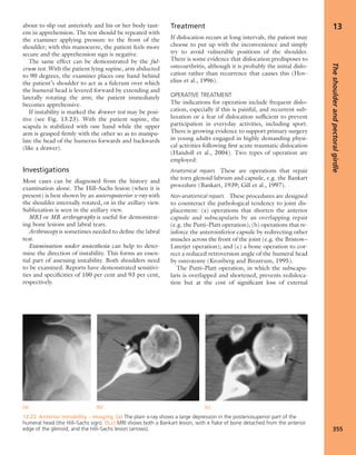 Apley's shoulderjt examination