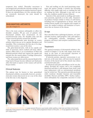 Apley's shoulderjt examination