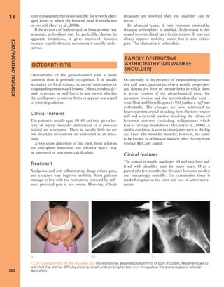 Apley's shoulderjt examination