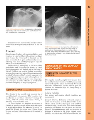 Apley's shoulderjt examination