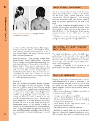 Apley's shoulderjt examination