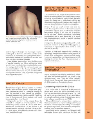 Apley's shoulderjt examination
