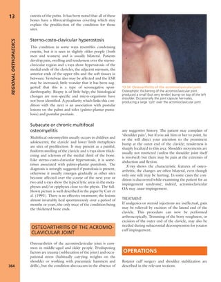 Apley's shoulderjt examination
