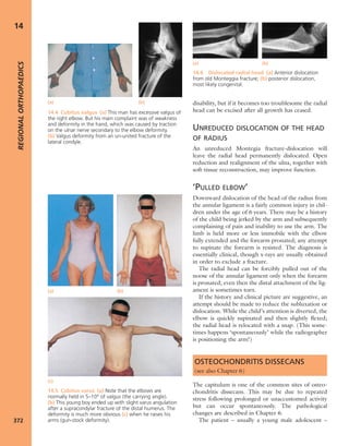 Apley's shoulderjt examination