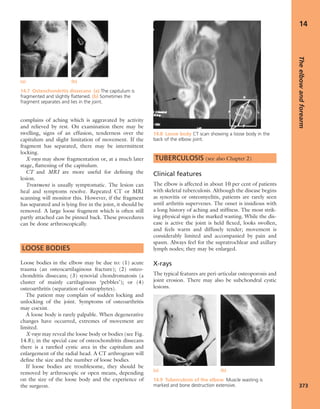 Apley's shoulderjt examination