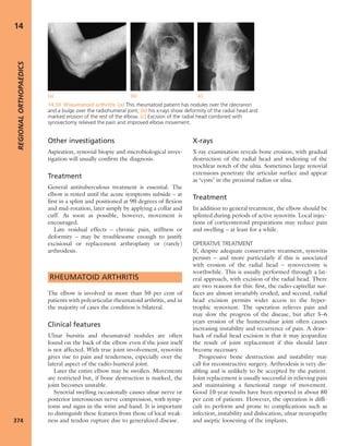 Apley's shoulderjt examination