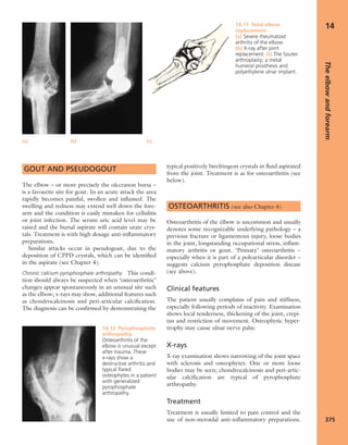 Apley's shoulderjt examination