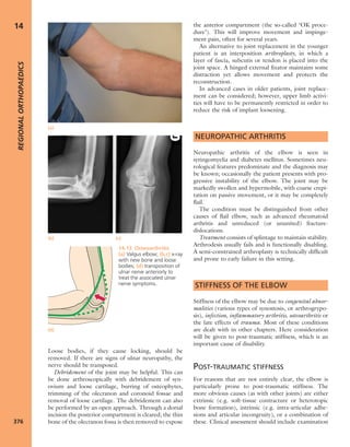 Apley's shoulderjt examination