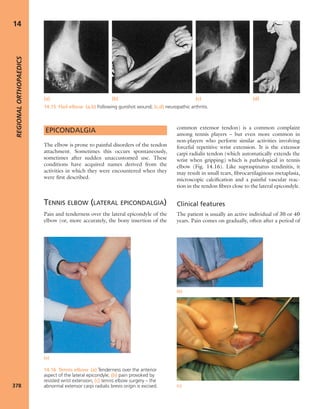 Apley's shoulderjt examination