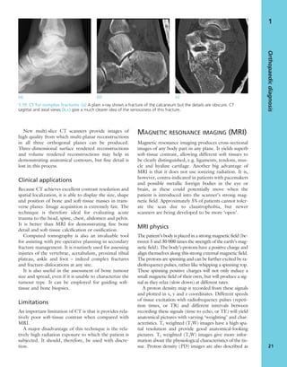 New multi-slice CT scanners provide images of
high quality from which multi-planar reconstructions
in all three orthogonal planes can be produced.
Three-dimensional surface rendered reconstructions
and volume rendered reconstructions may help in
demonstrating anatomical contours, but ﬁne detail is
lost in this process.
Clinical applications
Because CT achieves excellent contrast resolution and
spatial localization, it is able to display the size, shape
and position of bone and soft-tissue masses in trans-
verse planes. Image acquisition is extremely fast. The
technique is therefore ideal for evaluating acute
trauma to the head, spine, chest, abdomen and pelvis.
It is better than MRI for demonstrating ﬁne bone
detail and soft-tissue calciﬁcation or ossiﬁcation.
Computed tomography is also an invaluable tool
for assisting with pre-operative planning in secondary
fracture management. It is routinely used for assessing
injuries of the vertebrae, acetabulum, proximal tibial
plateau, ankle and foot – indeed complex fractures
and fracture-dislocations at any site.
It is also useful in the assessment of bone tumour
size and spread, even if it is unable to characterize the
tumour type. It can be employed for guiding soft-
tissue and bone biopsies.
Limitations
An important limitation of CT is that it provides rela-
tively poor soft-tissue contrast when compared with
MRI.
A major disadvantage of this technique is the rela-
tively high radiation exposure to which the patient is
subjected. It should, therefore, be used with discre-
tion.
MAGNETIC RESONANCE IMAGING (MRI)
Magnetic resonance imaging produces cross-sectional
images of any body part in any plane. It yields superb
soft-tissue contrast, allowing different soft tissues to
be clearly distinguished, e.g. ligaments, tendons, mus-
cle and hyaline cartilage. Another big advantage of
MRI is that it does not use ionizing radiation. It is,
however, contra-indicated in patients with pacemakers
and possible metallic foreign bodies in the eye or
brain, as these could potentially move when the
patient is introduced into the scanner’s strong mag-
netic ﬁeld. Approximately 5% of patients cannot toler-
ate the scan due to claustrophobia, but newer
scanners are being developed to be more ‘open’.
MRI physics
The patient’s body is placed in a strong magnetic ﬁeld (be-
tween 5 and 30 000 times the strength of the earth’s mag-
netic ﬁeld). The body’s protons have a positive charge and
align themselves along this strong external magnetic ﬁeld.
The protons are spinning and can be further excited by ra-
diofrequency pulses, rather like whipping a spinning top.
These spinning positive charges will not only induce a
small magnetic ﬁeld of their own, but will produce a sig-
nal as they relax (slow down) at different rates.
A proton density map is recorded from these signals
and plotted in x, y and z coordinates. Different speeds
of tissue excitation with radiofrequency pulses (repeti-
tion times, or TR) and different intervals between
recording these signals (time to echo, or TE) will yield
anatomical pictures with varying ‘weighting’ and char-
acteristics. T1 weighted (T1W) images have a high spa-
tial resolution and provide good anatomical-looking
pictures. T2 weighted (T2W) images give more infor-
mation about the physiological characteristics of the tis-
sue. Proton density (PD) images are also described as
Orthopaedicdiagnosis
21
1
(a) (b) (c)
1.19 CT for complex fractures (a) A plain x-ray shows a fracture of the calcaneum but the details are obscure. CT
sagittal and axial views (b,c) give a much clearer idea of the seriousness of this fracture.
 