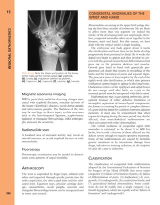 Apley's shoulderjt examination