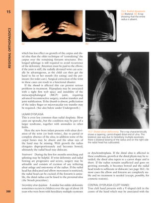 Apley's shoulderjt examination