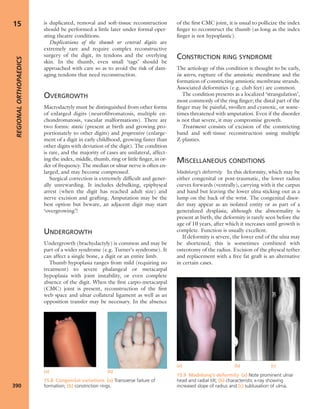 Apley's shoulderjt examination