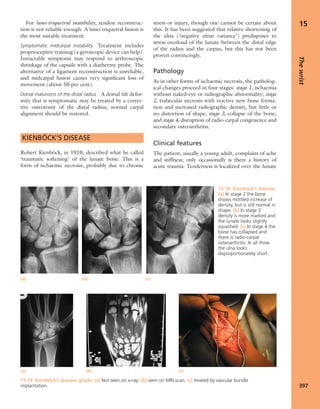 Apley's shoulderjt examination