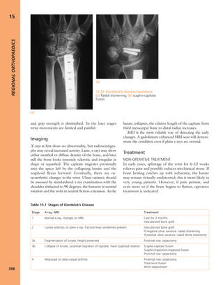 Apley's shoulderjt examination