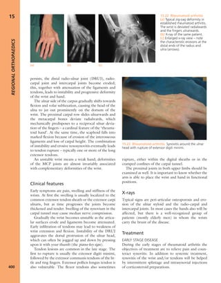 Apley's shoulderjt examination