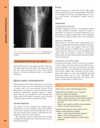 Apley's shoulderjt examination