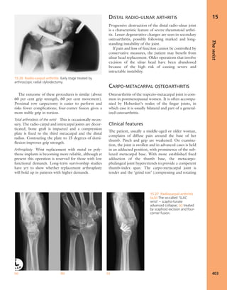 Apley's shoulderjt examination
