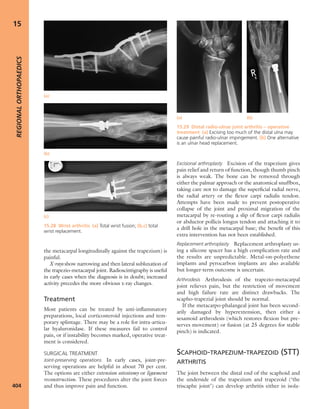 Apley's shoulderjt examination