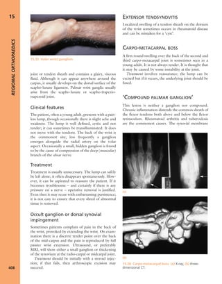 Apley's shoulderjt examination