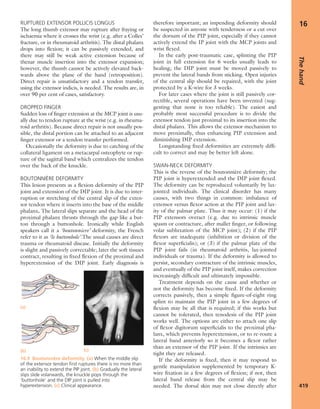 Apley's shoulderjt examination