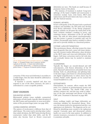 Apley's shoulderjt examination