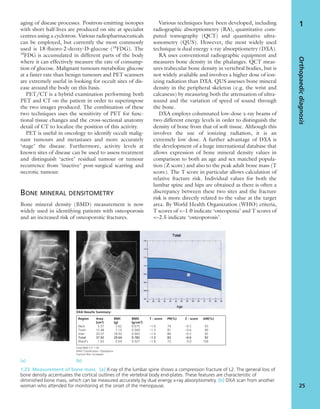 aging of disease processes. Positron-emitting isotopes
with short half-lives are produced on site at specialist
centres using a cyclotron. Various radiopharmaceuticals
can be employed, but currently the most commonly
used is 18-ﬂuoro-2-deoxy-D-glucose (18
FDG). The
18
FDG is accumulated in different parts of the body
where it can effectively measure the rate of consump-
tion of glucose. Malignant tumours metabolize glucose
at a faster rate than benign tumours and PET scanners
are extremely useful in looking for occult sites of dis-
ease around the body on this basis.
PET/CT is a hybrid examination performing both
PET and CT on the patient in order to superimpose
the two images produced. The combination of these
two techniques uses the sensitivity of PET for func-
tional tissue changes and the cross-sectional anatomy
detail of CT to localize the position of this activity.
PET is useful in oncology to identify occult malig-
nant tumours and metastases and more accurately
‘stage’ the disease. Furthermore, activity levels at
known sites of disease can be used to assess treatment
and distinguish ‘active’ residual tumour or tumour
recurrence from ‘inactive’ post-surgical scarring and
necrotic tumour.
BONE MINERAL DENSITOMETRY
Bone mineral density (BMD) measurement is now
widely used in identifying patients with osteoporosis
and an increased risk of osteoporotic fractures.
Various techniques have been developed, including
radiographic absorptiometry (RA), quantitative com-
puted tomography (QCT) and quantitative ultra-
sonometry (QUS). However, the most widely used
technique is dual energy x-ray absorptiometry (DXA).
RA uses conventional radiographic equipment and
measures bone density in the phalanges. QCT meas-
ures trabecular bone density in vertebral bodies, but is
not widely available and involves a higher dose of ion-
izing radiation than DXA. QUS assesses bone mineral
density in the peripheral skeleton (e.g. the wrist and
calcaneus) by measuring both the attenuation of ultra-
sound and the variation of speed of sound through
the bone.
DXA employs columnated low-dose x-ray beams of
two different energy levels in order to distinguish the
density of bone from that of soft tissue. Although this
involves the use of ionizing radiation, it is an
extremely low dose. A further advantage of DXA is
the development of a huge international database that
allows expression of bone mineral density values in
comparison to both an age and sex matched popula-
tion (Z score) and also to the peak adult bone mass (T
score). The T score in particular allows calculation of
relative fracture risk. Individual values for both the
lumbar spine and hips are obtained as there is often a
discrepancy between these two sites and the fracture
risk is more directly related to the value at the target
area. By World Health Organization (WHO) criteria,
T scores of <–1.0 indicate ‘osteopenia’ and T scores of
<–2.5 indicate ‘osteoporosis’.
Orthopaedicdiagnosis
25
1
1.23 Measurement of bone mass (a) X-ray of the lumbar spine shows a compression fracture of L2. The general loss of
bone density accentuates the cortical outlines of the vertebral body end-plates. These features are characteristic of
diminished bone mass, which can be measured accurately by dual energy x-ray absorptiometry. (b) DXA scan from another
woman who attended for monitoring at the onset of the menopause.
(a) (b)
Region Area BMC BMD T - score PR(%) Z - score AM(%)
(cm2
) (g) (g/cm2
)
Neck 5.37 3.62 0.675 –1.6 79 –0.5 93
Troch 12.48 7.10 0.569 –1.3 81 –0.6 90
Inter 20.07 18.92 0.943 –1.0 86 –0.5 92
Total 37.92 29.64 0.782 –1.3 83 –0.6 92
Ward’s 1.03 0.54 0.527 –1.8 72 0.0 100
DXA Results Summary:
Total BMD CV 1.)%
WHO Classiﬁcation: Osteopenia
Fracture Risk: Increased
 