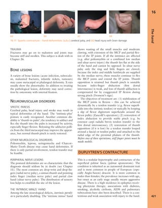 Apley's shoulderjt examination