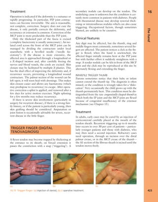 Apley's shoulderjt examination