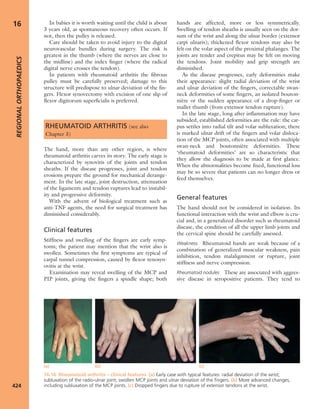 Apley's shoulderjt examination