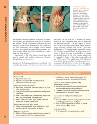 Apley's shoulderjt examination