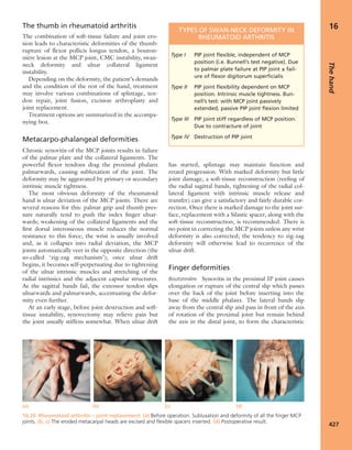 Apley's shoulderjt examination