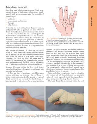 Apley's shoulderjt examination