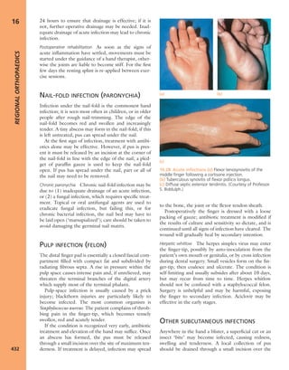 Apley's shoulderjt examination