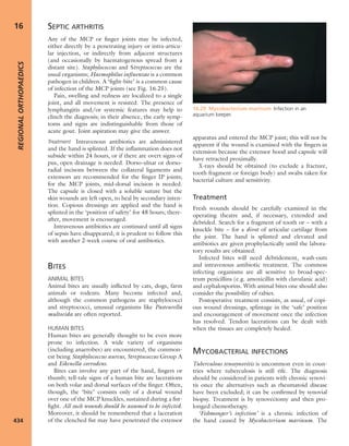 Apley's shoulderjt examination