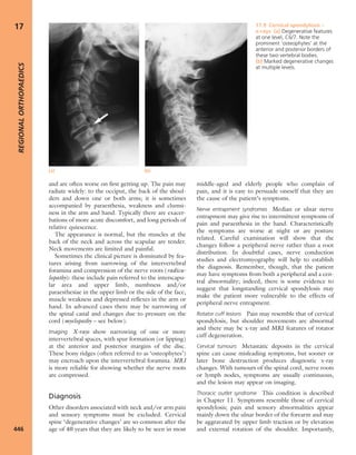 Apley's shoulderjt examination