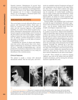 Apley's shoulderjt examination