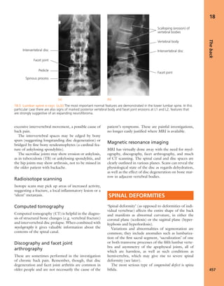 Apley's shoulderjt examination