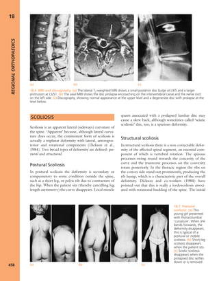 Apley's shoulderjt examination