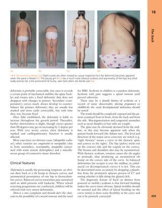 Apley's shoulderjt examination